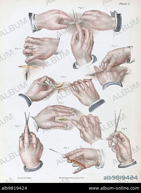 Medicine; Surgery; Illustration of the surgical procedure; Hand with various surgical tools; 1800; Historic; digitally restored reproduction from a 19th century original.