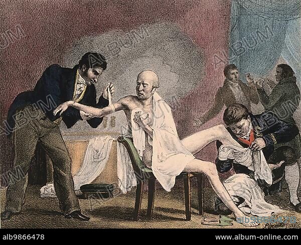 An emaciated old man being treated by four doctors, 1852, a steam bath billows in the background. The two men on the far right hold a glass eye and a pair of false teeth, France, Historic, digitally restored reproduction of an original of the period, Europe.