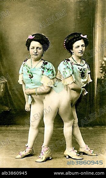 The Siamese twins Josefa and Rosa Blazek, 1910s, Bohemia, Germany, Europe.