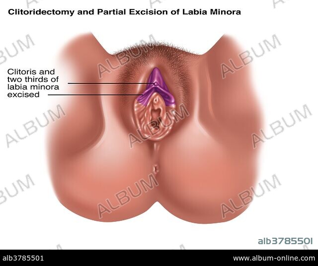 Klitoris azobda Klitoris azobda