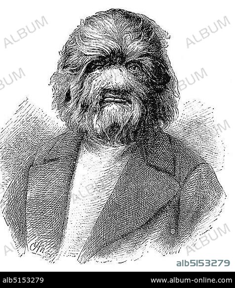 Dog-Faced Man, Fedor Adrianovich Jeftichew, Fyodor Yevtishchev, born 1868, died 1904, better known as Jo-Jo the Dog-Faced Boy, Dog-Faced Man, Russia, Europe.