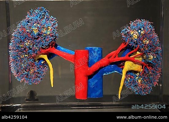 Plastinate, human kidney vascular system, Body Worlds, Menschen Museum, Berlin, Germany, Europe.
