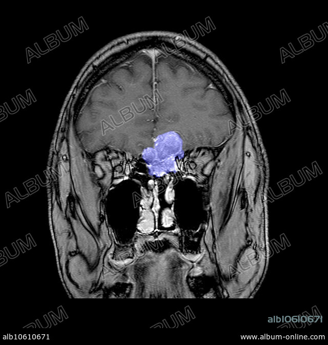 メディカルスキャニング – 最新鋭MRI・CTでの画像検査・診断クリニックネットワーク