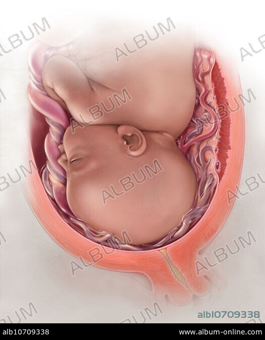 拙作「Placenta」 ZX-1700PN Human Placenta Model with Cord at ₹ 4700/piece