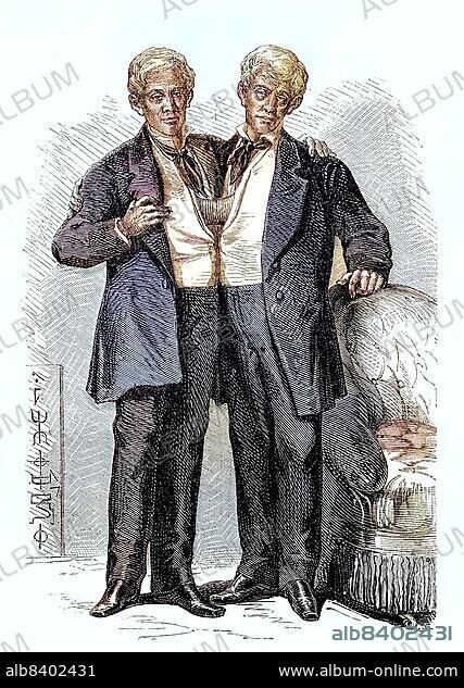 Chang and Eng Bunker, 11 May 1811, 17 January 1874, were conjoined twins who gave their name to this deformity, Historical, digitally restored reproduction of a 19th century original.