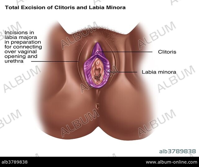 Yetuk dumbalarning miltillashi Denis Richards sohilda yalangoch holda