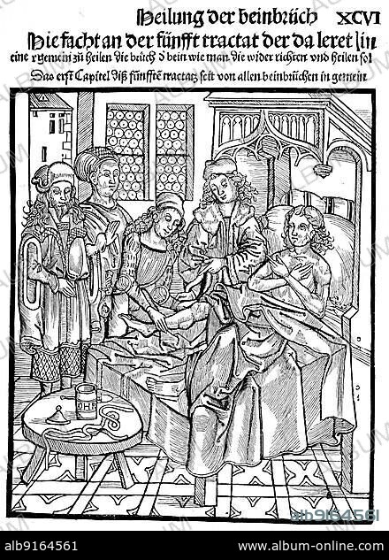 Doctors examining a sick man with a broken leg, Germany, facsimile of a woodcut from the Book of Miraculous Doctors, 1550, digitally restored reproduction of a 19th century original, exact original date not known, Europe.