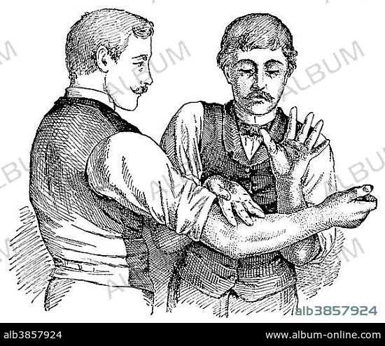 Tapotement massage technique, state of the art of therapeutic techniques, early 20th Century, illustration.
