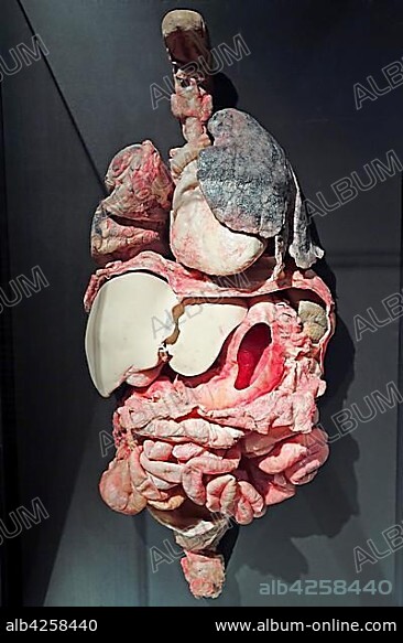 Plastinate, human internal organs, chronic obstructive pulmonary disease, Body Worlds, Menschen Museum, Berlin, Germany, Europe.