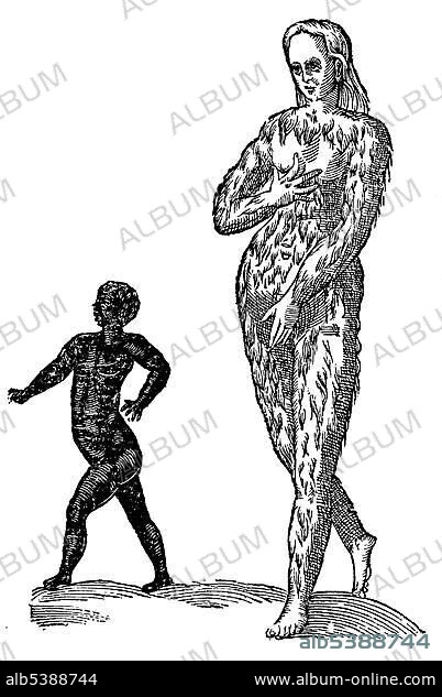 Woodcut, Infans aethiops et virgo villosa, Ethiopian child and hairy virgin, Aldrovandi, Historia Monstrorum, 1642, Renaissance.