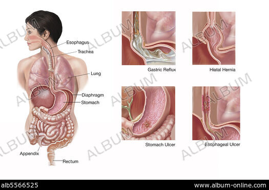 album_alb5565803.jpg