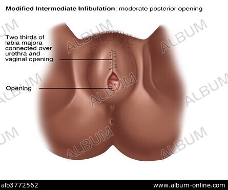 clitorisclitoris CLITORIS - Stock Photos, Illustrations and Images - Album