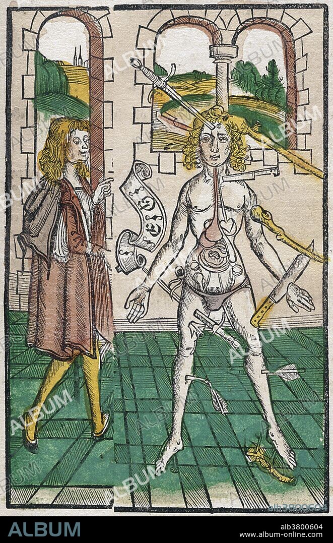 Brunschwig's chapter on surgery and treatments of wounds includes a common medieval medical illustration known as the "Wound Man" and describes distillate therapies to be used on wounds. This "Wound Man" illustration shows internal organs and the many types of wounds caused by weapons. The man in the short red coat is most likely the alchemist's apprentice. Brunschwig's Liber de arte distillandi simplicia et composita (Little Book of Distillation) which one of the earliest books ever written concerning the subjects of chemistry and pharmacology. Printed in Strasbourg in 1512, it is a practical manual on chemical, alchemical, and distillation devices and techniques used to manufacture drug therapies. It includes instructions on how to distill aqua vitae, potable gold, artificial and natural balsams and how to use distillates to treat illnesses in surgical cases. The last of the 16th century herbals, this book is widely regarded to be an important link between the Middle Ages and modern times. Hieronymus Brunschwig (1450 - 1512), was a German physician, surgeon, chemist, and pharmacologist. He was notable for his early work on chemical techniques, as well as his methods of treatment of gunshot wounds. He died in 1512 at the age of 61 or 62.