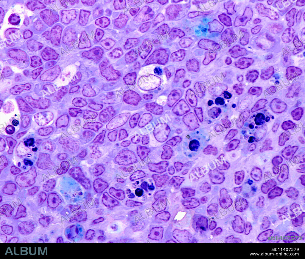 Germinal center of a lymphoid secondary follicle showing centroblasts, large clear macrophages with phagocyted cell debris, and apoptotic cells (bottom center). 0.5 micrometre thick section of plastic embedded material stained with toluidine blue.