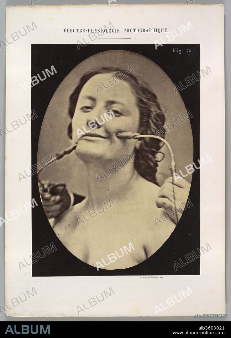 Figure 78: Scene of coquetry. Artist: Guillaume-Benjamin-Amand Duchenne de Boulogne (French, 1806-1875); Adrien Tournachon (French, 1825-1903). Dimensions: Image (Oval): 28.5 × 20.3 cm (11 1/4 × 8 in.)
Sheet: 30.1 × 21.9 cm (11 7/8 × 8 5/8 in.)
Mount: 40.2 × 28.6 cm (15 13/16 × 11 1/4 in.). Date: 1854-56, printed 1862.