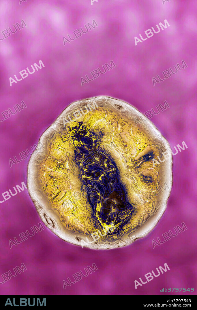 Transmission electron micrograph (TEM) of the human immunodeficiency virus (HIV). HIV is responsible for AIDS (Acquired Immunodeficiency Syndrome ). HIV is a retrovirus of the lentivirus kind. It realizes a long incubation period, with a slow disease evolution. AIDS is contagious by sexual or blood way, and often provokes a mortal collapse of the immune system. Viral magnification 690,000 X at 10 cm and image colorization with HDRI treatments. Viral diameter approximately: 145 nm.