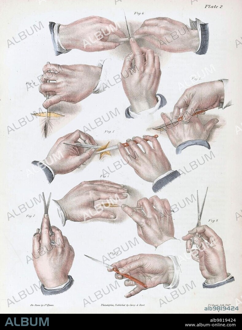 Medicine, Surgery, Illustration of the surgical procedure, Hand with various surgical tools, 1800, Historic, digitally restored reproduction from a 19th century original