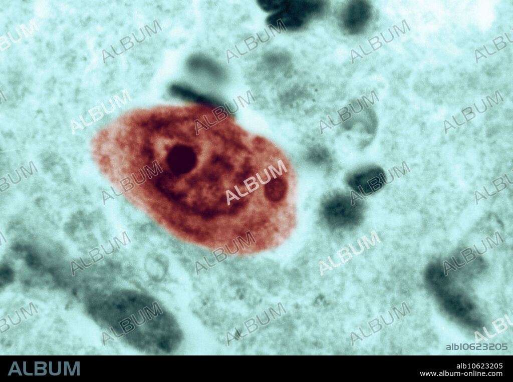 Colour-enhanced Transmission Electron Micrograph (TEM) of Negri bodies. Negri bodies are also known as Negri corpuscles or Negri cytoplasmic inclusions. These bodies are found in the purkinje cells of the brain in cases of rabies. Magnification: 2,500x.