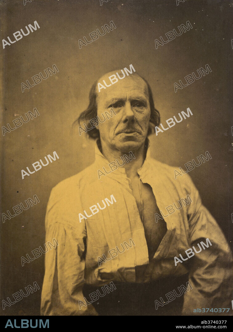 GUILLAUME-BENJAMIN-AMANT DUCHENNE (DE BOULOGNE). Face in repose, plate 3 from the album, The Mechanism of Human Facial Expression. Dated: 1854-1856. Dimensions: image: 22.5 × 16.5 cm (8 7/8 × 6 1/2 in.)  mount: 40.4 × 27.5 cm (15 7/8 × 10 13/16 in.). Medium: albumen print, printed 1862.