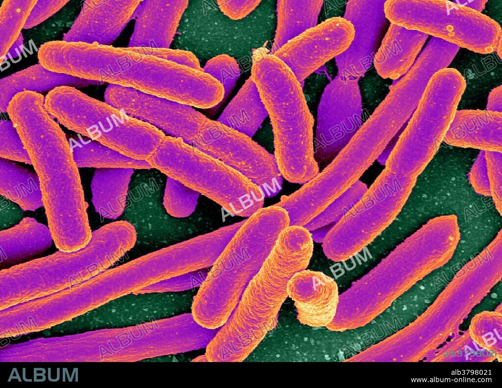 Color enhanced scanning electron micrograph of Escherichia coli, grown in culture and adhered to a cover slip. Escherichia coli is a Gram-negative, rod-shaped bacterium that is commonly found in the lower intestine of warm-blooded organisms (endotherms). Most E. coli strains are harmless, but some serotypes can cause serious food poisoning in humans, and are occasionally responsible for product recalls due to food contamination.