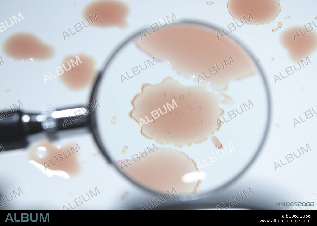A magnifying glass is used to look at a blood splatter.