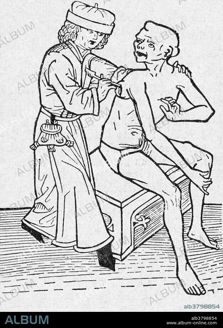 One of the first known illustrations of a physician lancing a wound -- here, a boil or vesicle on a plague victim.