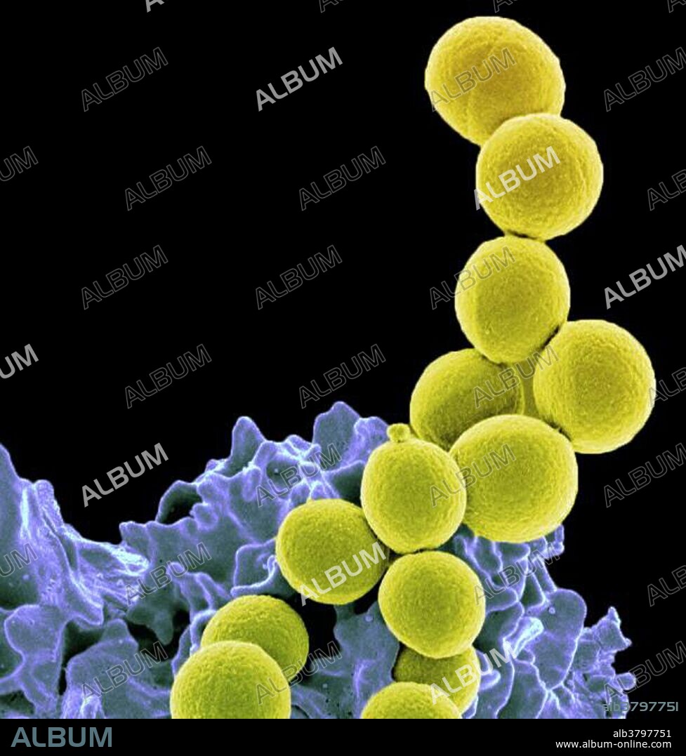Scanning electron micrograph of methicillin-resistant Staphylococcus aureus (MRSA, yellow) being ingested by neutrophil (purplish blue). Methicillin-resistant Staphylococcus aureus (MRSA) is a bacterium responsible for several difficult-to-treat infections in humans. It is also called multidrug-resistant Staphylococcus aureus and oxacillin-resistant Staphylococcus aureus (ORSA). MRSA is any strain of Staphylococcus aureus that has developed resistance to beta-lactam antibiotics, which include penicillins and cephalosporins. Strains unable to resist these antibiotics are classified as methicillin-sensitive Staphylococcus aureus, or MSSA. The development of such resistance does not cause the organism to be more intrinsically virulent than strains of Staphylococcus aureus that have no antibiotic resistance, but resistance does make MRSA infection more difficult to treat with standard types of antibiotics and thus more dangerous. MRSA is especially troublesome in hospitals and nursing homes, where patients with open wounds, invasive devices, and weakened immune systems are at greater risk of infection than the general public.