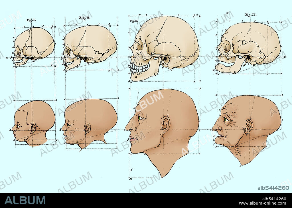 On the first canvas the head of a child, the head of an adult man, and the head of an old man were shown with their skulls above them, all in profile. Facial Angles refers to the content of two lectures by Petrus Camper on August 1st and 8th in 1770 to the Amsterdam Drawing Academy. Camper's main points in his first lecture were that classical drawing lessons from the time of Vitruvius, including the teachings of Dürer and Perreault, were based on an incorrect assumption that the human head was oval at all ages, and he proceeded to prove this with his dimensions of the skulls. He then demonstrated on his sketches, by shortening the chin he could transform a likeness of a man to an old man, and by adjusting the facial angle, he changed a Moor into a European. Camper's work was later quoted again and again, and his engraved drawings were used to prove that he had tried to show a hierarchy of facial angles from the orangutan to the European, but this was never part of either of the two lectures. In fact, he was only trying to help artists make better portraits. Petrus Camper (May 11, 1722 - April 7, 1789) was a Dutch physician, anatomist, physiologist, midwife, zoologist, anthropologist, paleontologist and a naturalist.