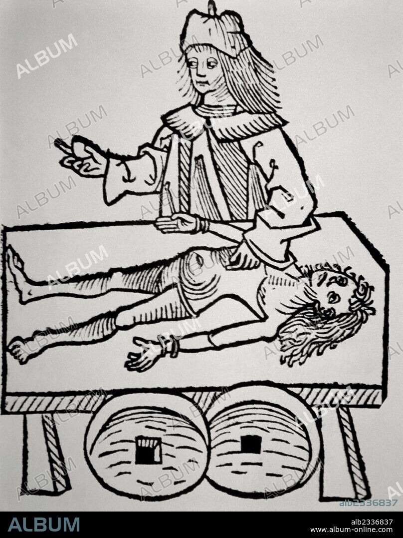 HISTORIA DE LA MEDICINA. EDAD MODERNA. MEDICO OPERANDO UN CALCULO DE LA VESICULA DE UN PACIENTE. Xilografía de la obra "Hortus Sanitatis" (siglo XV) .