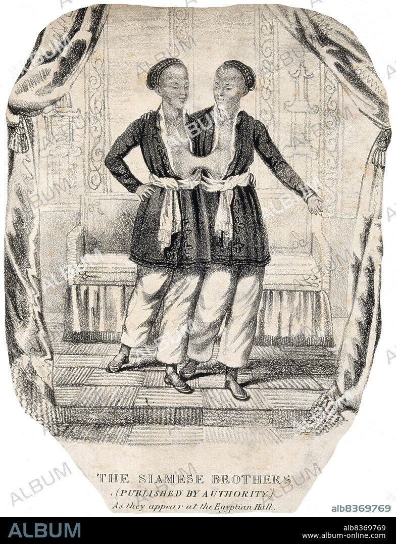 Chang and Eng Bunker (May 11, 1811 January 17, 1874) were Thai-American conjoined twin brothers whose condition and birthplace became the basis for the term 'Siamese twins'.<br/><br/>. The Bunker brothers were born on May 11, 1811, in the province of Samut Songkram, near Bangkok, in the Kingdom of Siam (today's Thailand). Their fisherman father was a Chinese Thai, while their mother was a Chinese Malaysian. Because of their Chinese heritage, they were known locally as the 'Chinese Twins'. The brothers were joined at the sternum by a small piece of cartilage, and though their livers were fused, they were independently complete.<br/><br/>. In 1829, Robert Hunter, a Scottish merchant who lived in Bangkok, saw the twins swimming and realized their potential. He paid their parents to permit him to exhibit their sons as a curiosity on a world tour. When their contract with Hunter was over, Chang and Eng went into business for themselves. In 1839, while visiting Wilkesboro, North Carolina, the brothers were attracted to the area and purchased a 110-acre (0.45 km2) farm in nearby Traphill.<br/><br/>. Determined to live as normal a life they could, Chang and Eng settled on their small plantation and bought slaves to do the work they could not do themselves. Using their adopted name 'Bunker', they married local women on April 13, 1843. Chang wed Adelaide Yates, while Eng married her sister, Sarah Anne. Chang and Adelaide would become the parents of eleven children. Eng and Sarah had ten. The twins also became naturalized American citizens.<br/><br/>. On January 17, 1874, Chang died while the brothers were asleep. Eng awoke to find his brother dead and cried, 'Then I am going'. A doctor was summoned to perform an emergency separation, but he was too late. Eng died approximately three hours later.