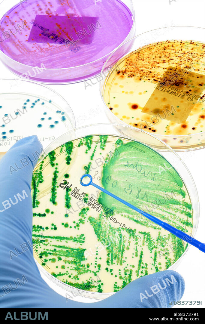 Sample of colonies on a petri dish with a platinum loop.