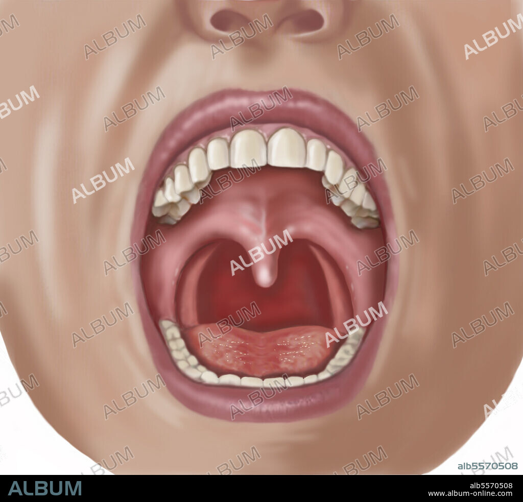 Looking into open mouth showing uvula, teeth, tongue and pharynx.