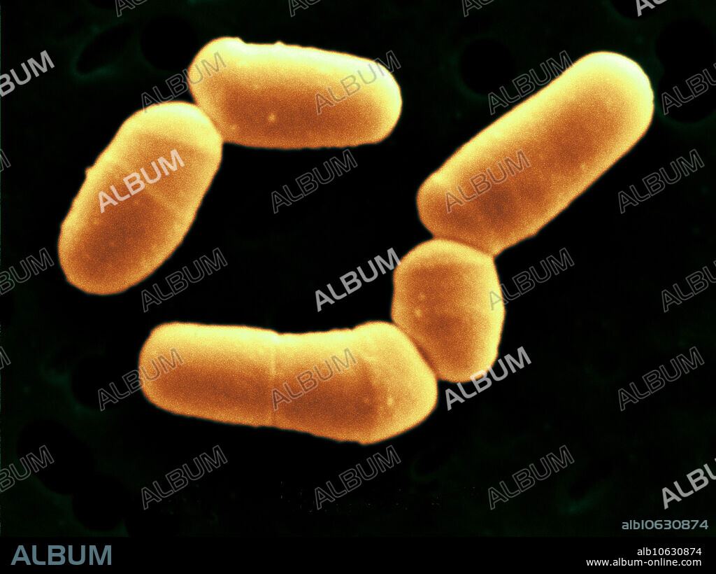 Scanning electron micrograph (SEM) of Bifidobacterium bifidum. Bifidobacterium bifidum is a member of the large family of probiotic (friendly) bifidobacteria which are present in mammalian gastrointestinal systems including humans and cattle, where they suppress pathogenic microorganisms. Some are also present in the intestines of poultry. They are used by the dairy industry in addition to lactobacilli and lactococci to make yogurt and are also part of medicinal supplements. (Microscope magnification: 16,000x, image width: 8.0 micrometers.).