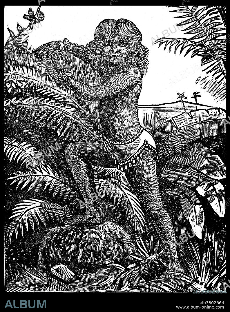 Krao Farini (1876 - April 16, 1926) was an American sideshow performer born with hypertrichosis. It is claimed that in January 1881, Krao and her parents were captured in Laos during an expedition conducted by the explorer Carl Bock. An anthropologist, George Shelly, was part of the expedition and took charge of Krao. She was described as being part of a primitive tribe of humans called "Kraos-monink" all of whom were covered in hair and lived in trees. By 1883, Krao was being exhibited in Europe as an example of a missing link between humanity and apes and proof of Charles Darwin's theory of evolution. She was given the surname of Farini at some point after her capture by sideshow promoter Guillermo Antonio Farini when he adopted her. She spent several decades exhibiting herself. She lived the last few years of her life in Brooklyn at 309 East 19th Street. When out in public but not on display she wore a veil. She died from influenza in 1926 at the age of 49 or 50. She requested her body to be cremated in order to avoid her body being gawked at.