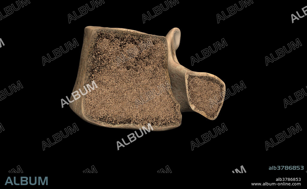A cross-section of the lumbar vertebra is demonstrated. The outer edges of the vertebra consists of thick cortical bone. The inner portion of the vertebra consists of trabeculated or spongy bone. The marrow within these trabeculations have been removed, showing only bone.