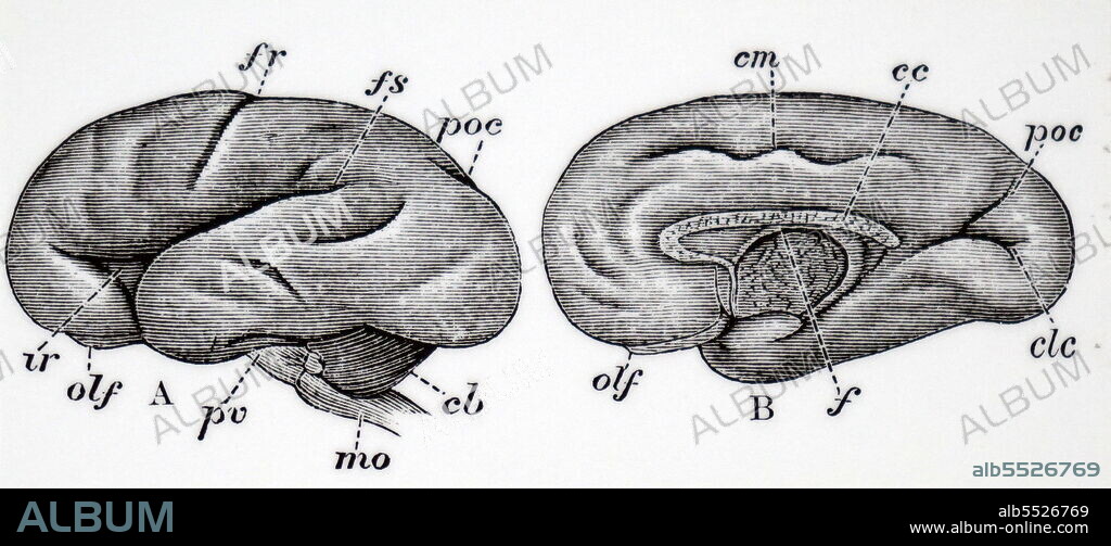 Vertical transverse section of the human brain.