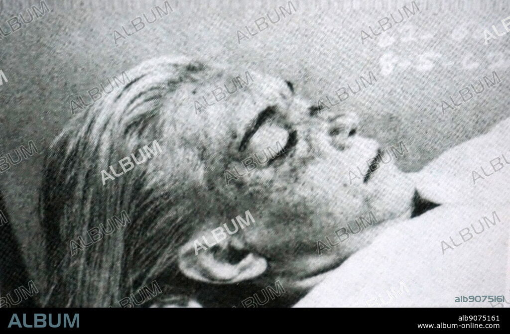 Marilyn Monroe's autopsy photograph. Marilyn Monroe (1926-1962) an American actress, model, and singer.