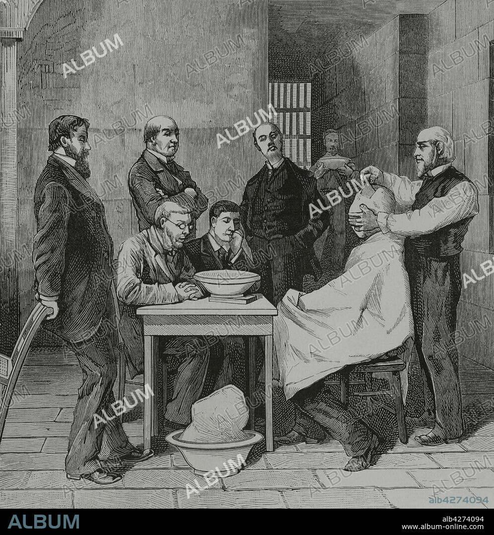 United States, Washington. Prison of Charles Julius Guiteau (1841-1882), assassin of the President James A. Garfield, on July 2, 1881. The sculptor Clark Mills (1810-1883) making a plaster cast of the head of the prosecuted, condemned to be hanged. Engraving. La Ilustración Española y Americana, 1882.
