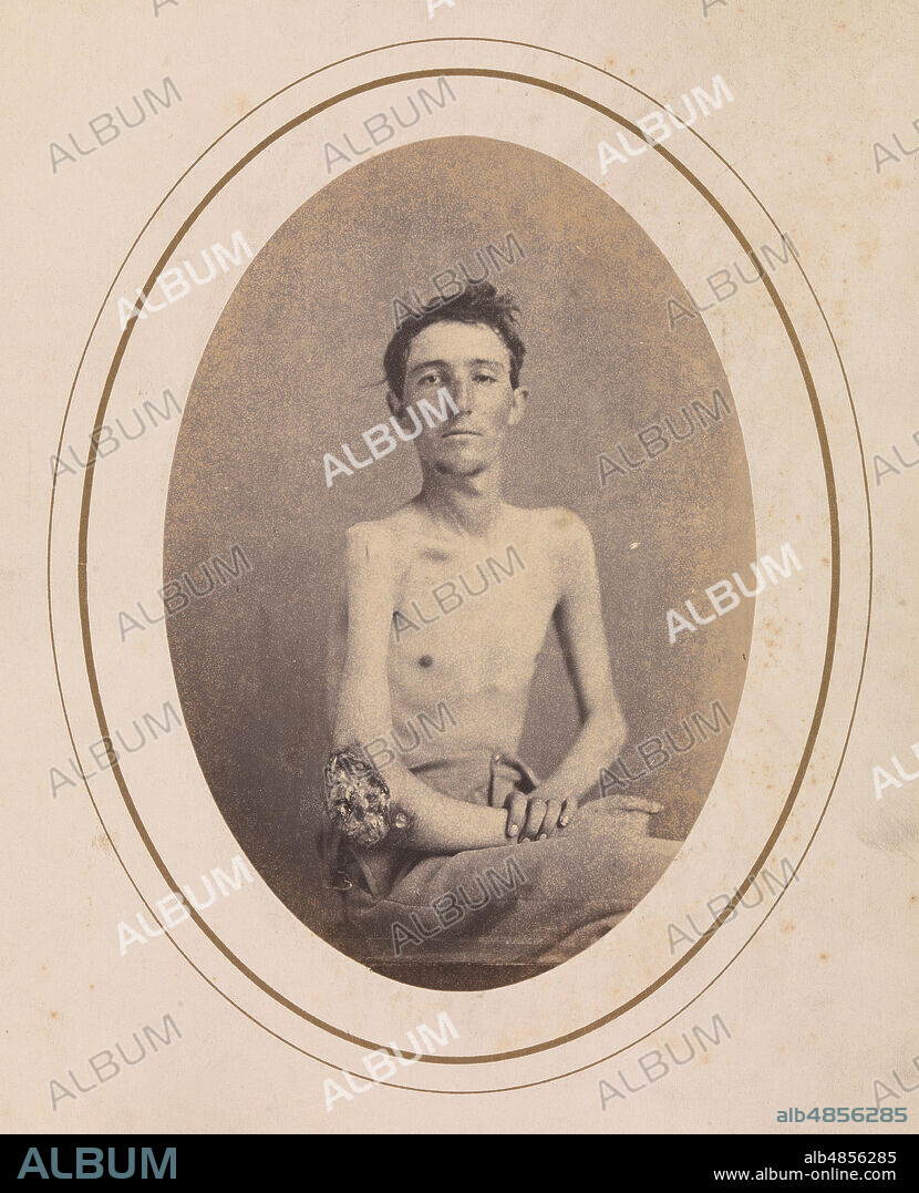 REED BROCKWAY BONTECOU. Private James H. Stokes, Company H, 185th New York Volunteers, April-May 1865.
