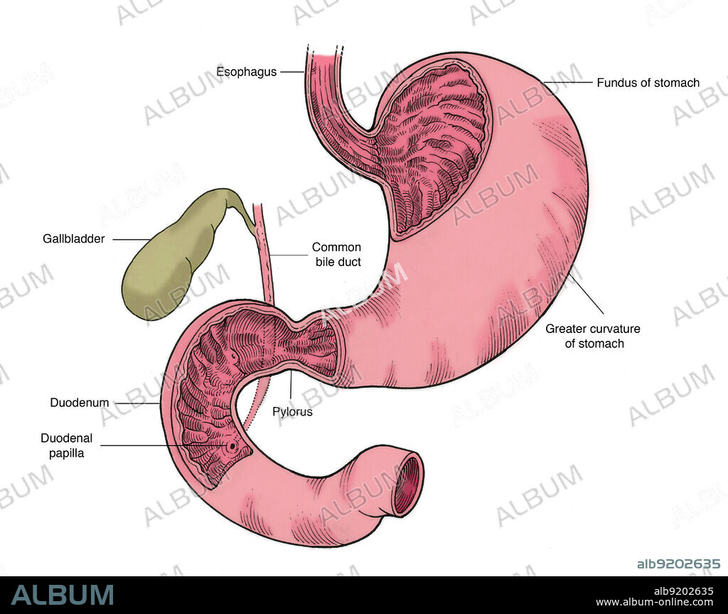 Anatomical illustration of the stomach and duodenum, showing esophagus, fundus of stomach, greater curvature of stomach, pylorus, common bile duct, duodenal papilla, and gallbladder.