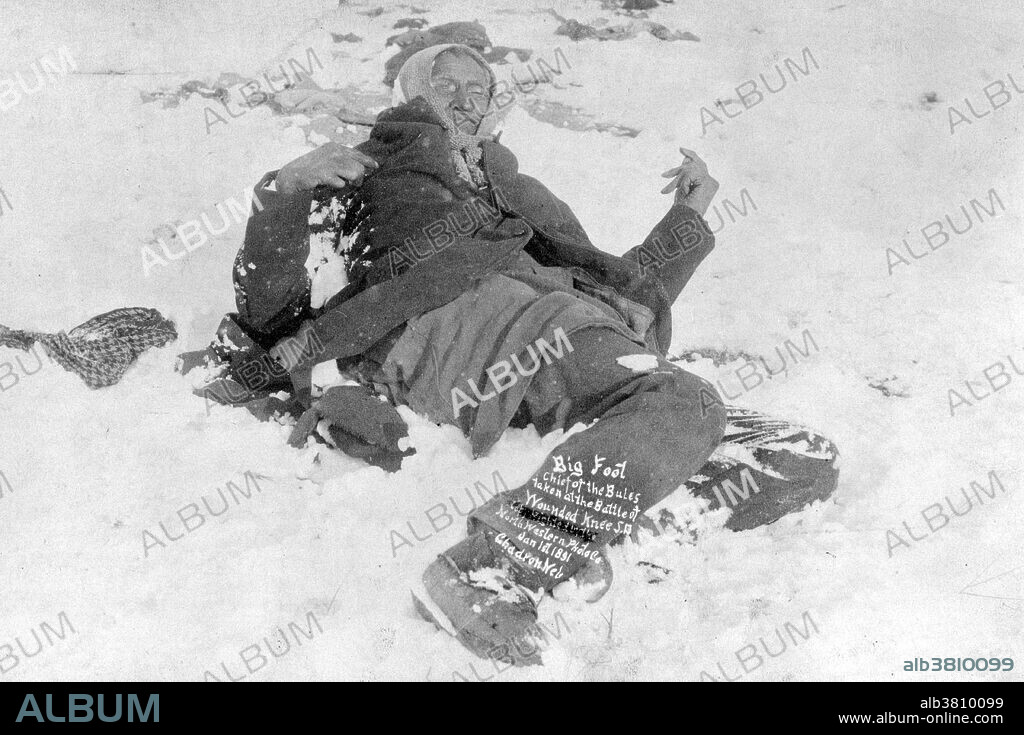 Body of Spotted Elk after the Massacre at Wounded Knee, photographed by Trager and Kuhn, 1891. Spotted Elk (1826 - December 29, 1890) was a chief of the Miniconjou, Lakota Sioux. He was considered a great man of peace, and was best known among his people for his political and diplomatic successes. During the 1870s, Spotted Elk allied his tribe against the US Army, together with half-brother Sitting Bull, cousin Crazy Horse and brother Touch the Clouds. When Sitting Bull was killed on Standing Rock Reservation, his followers fled for refuge at Spotted Elk's camp. Fearing arrest and government reprisals against his band, Spotted Elk led his band south to the Pine Ridge Reservation, at the invitation of Chief Red Cloud. He contracted pneumonia on the journey, surrendered peacefully and, with his band, was escorted to a campsite near Wounded Knee Creek. On the morning of December 29, 1890, Forsyth's soldiers entered the camp and demanded that the Lakota give up their weapons. A large gun fight quickly ensued and Spotted Elk was among those slain. The US forces killed 153 Lakota, mostly women and children in what became known as the Wounded Knee Massacre.