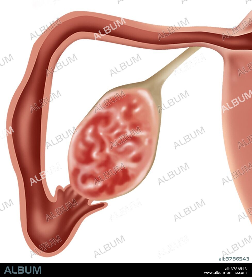 Illustration depicting a fallopian tube (oviduct) and ovary in cross section.