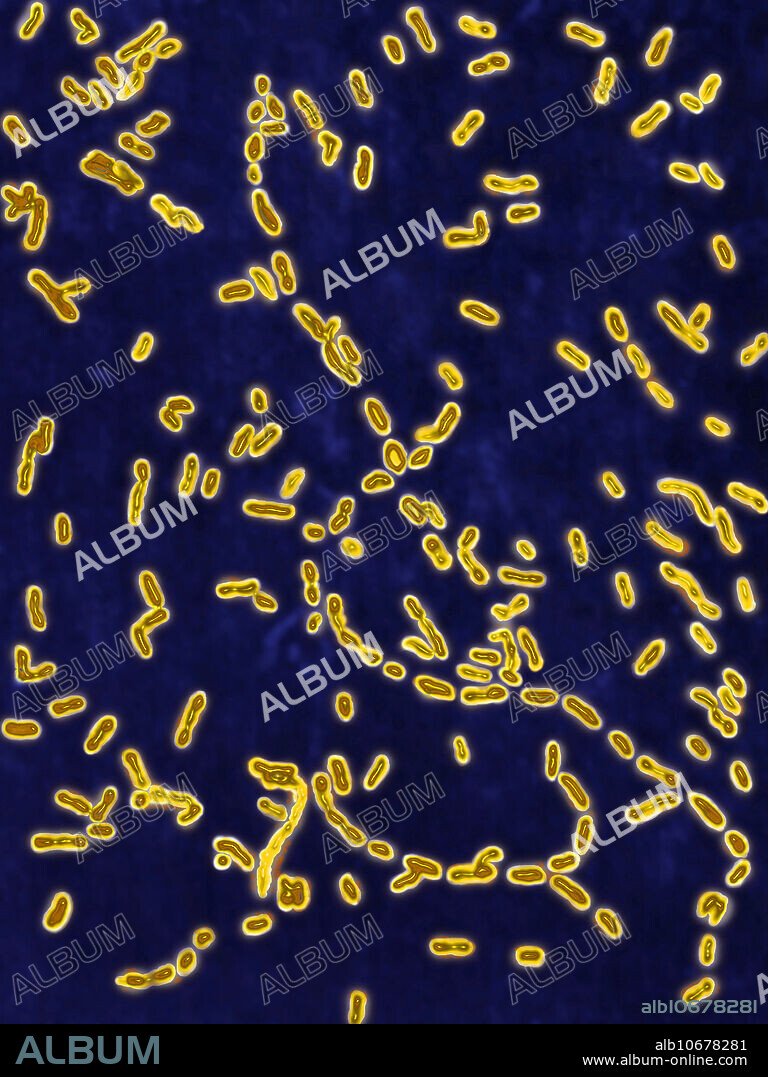 Colorized light micrograph showing Bordetella pertussis (Bordet-Gengou bacillus or Haemophilus pertussis), the causative agent of whooping cough. Bacteria settles in the trachea or bronchi and causes cough and fever with an mucus accumulation. Image colorization and HDRI treatments on optical microscopy; magnification X1000.