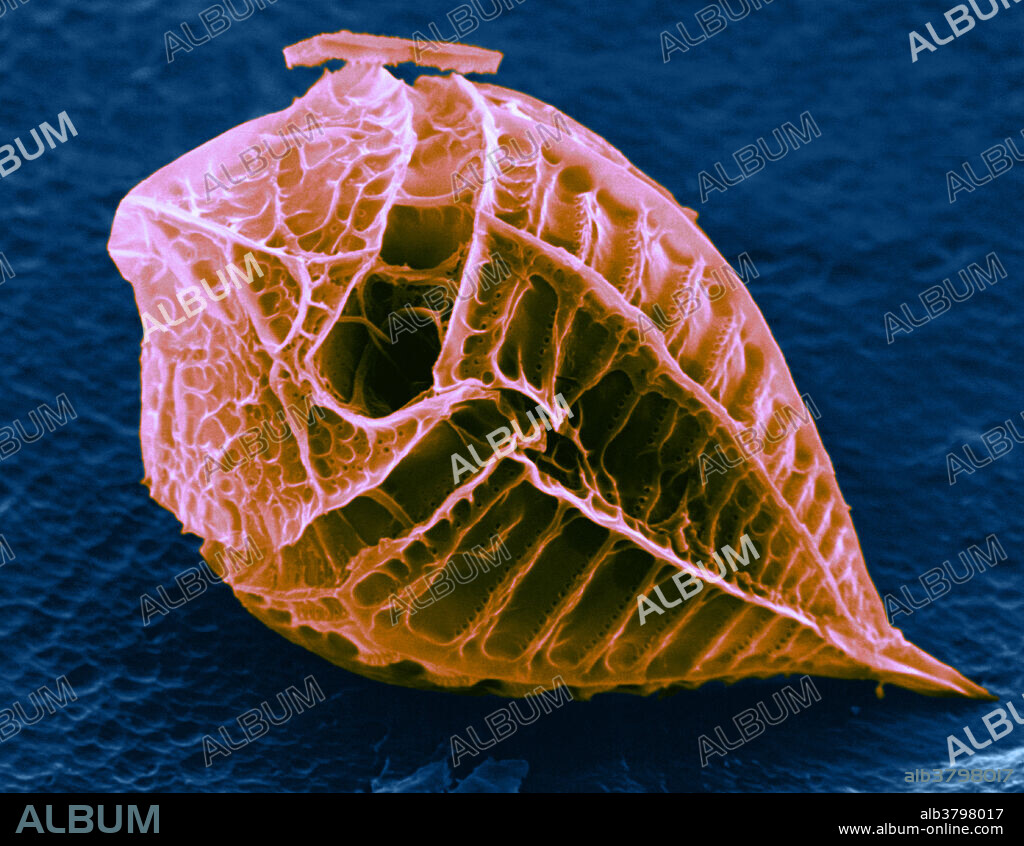 Oxytoxum Dinoflagellate