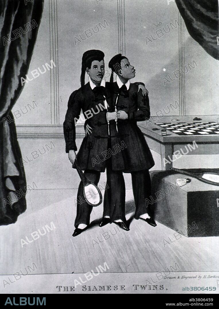 Two well-dressed young Siamese men, joined at the abdomen by a band of tissue, stand together on a stage beside a bench and table on which is a chess board; the man on the left holds a badminton racquet; another badminton racquet and shuttlecock sits on the bench; the man on the right is looking up towards the curtain to his left. Chang and Eng Bunker (May 11, 1811 - January 17, 1874) were the conjoined twin brothers whose condition and birthplace became the basis for the term "Siamese twins". The Bunker brothers were joined at the sternum by a small piece of cartilage. Their livers were fused but independently complete. In 1829, they were "discovered" in Siam by British merchant Robert Hunter and exhibited as a curiosity during a world tour. Upon termination of their contract they were determined to start living a normal life as much as possible They became naturalized United States citizens, settled on a plantation, in North Carolina, bought slaves and adopted the name "Bunker". The twins died on the same day in January 1874. Chang, who had contracted pneumonia, died rather suddenly in his sleep. Eng awoke to find his brother dead, and called for his wife and children to attend to him. A doctor was summoned to perform an emergency separation, but Eng refused to be separated from his dead brother. He died three hours later.