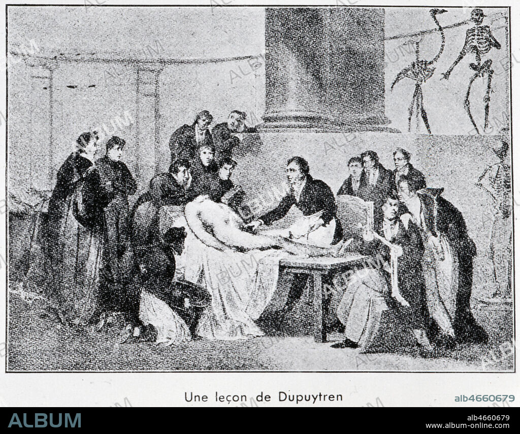 'Une lecon de DUPUYTREN (1777-1835)'. Lithographie du 19eme s. Credit : Collection KHARBINE-TAPABOR.