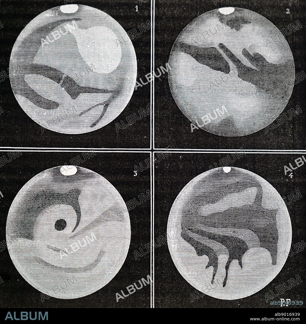 Telescopic view of Mars throughout 1877 from the Paris Observatory. Dated 19th century.