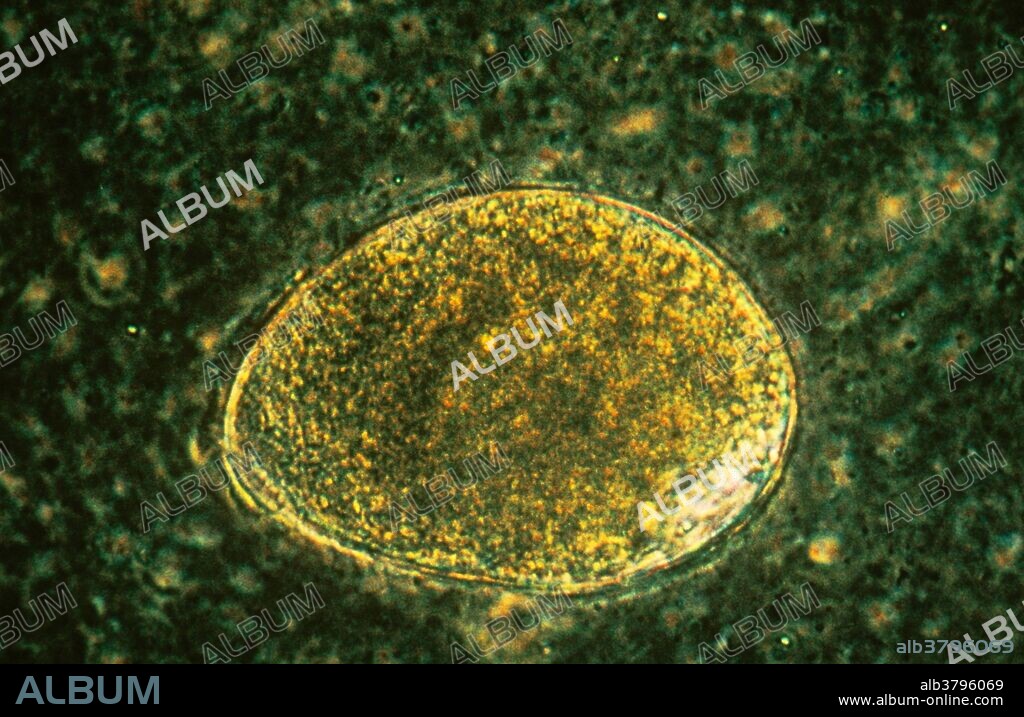 Living Nyctotherus sp., a ciliated protozoa.