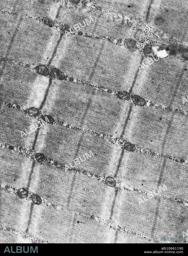 Contracted Skeletal Muscle (TEM)