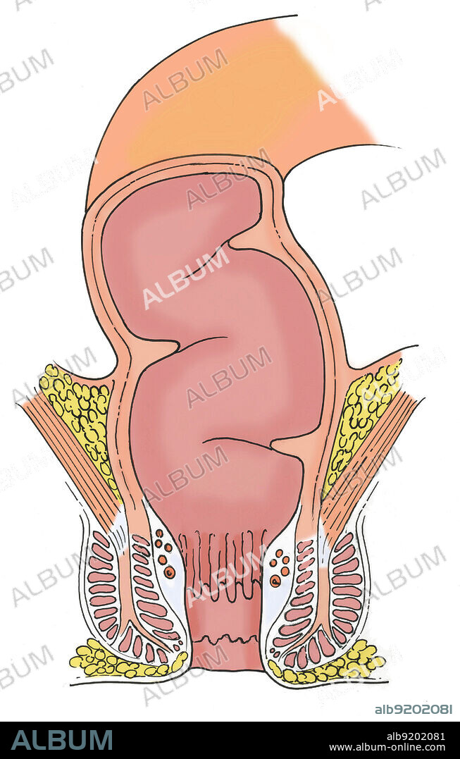 Anatomical illustration of rectum in frontal section, showing anus, anal canal, sphincter muscle, anal columns, levator ani muscle, internal rectum, and transverse fold.